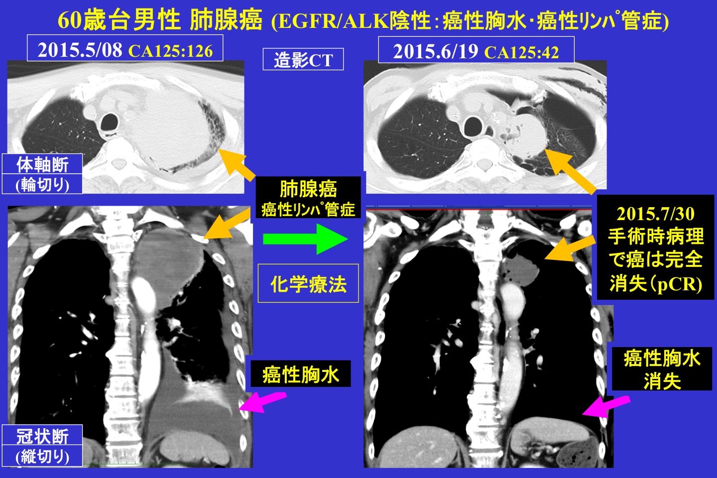 腫瘍内科