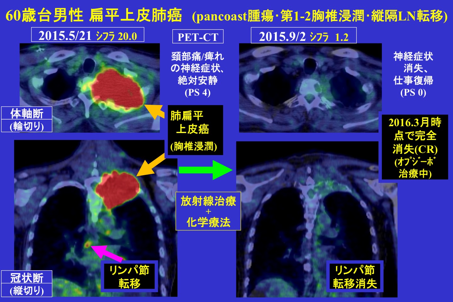 腫瘍内科