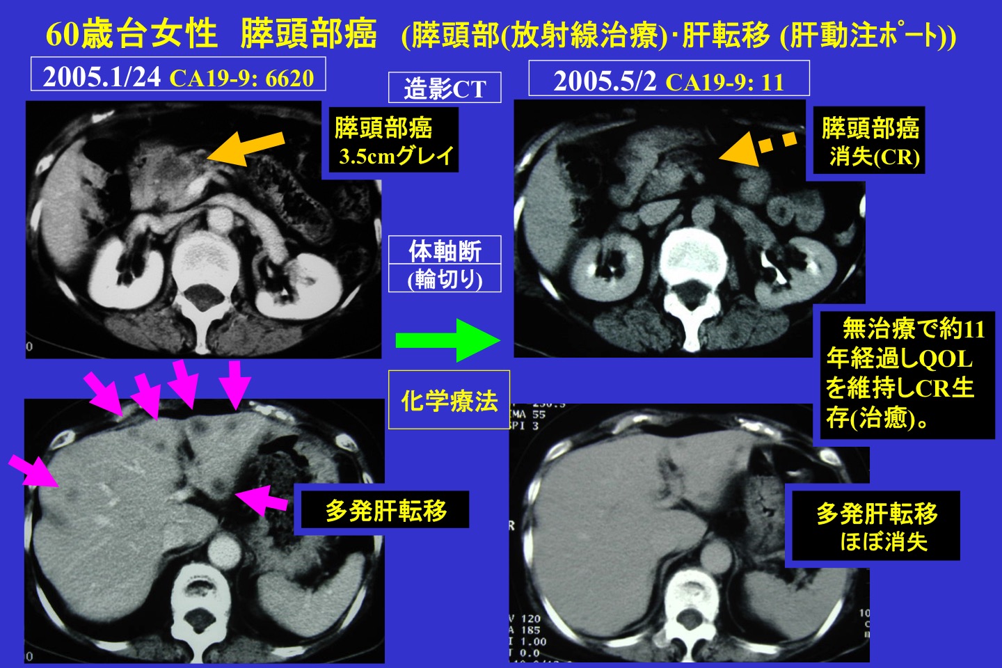 腫瘍内科