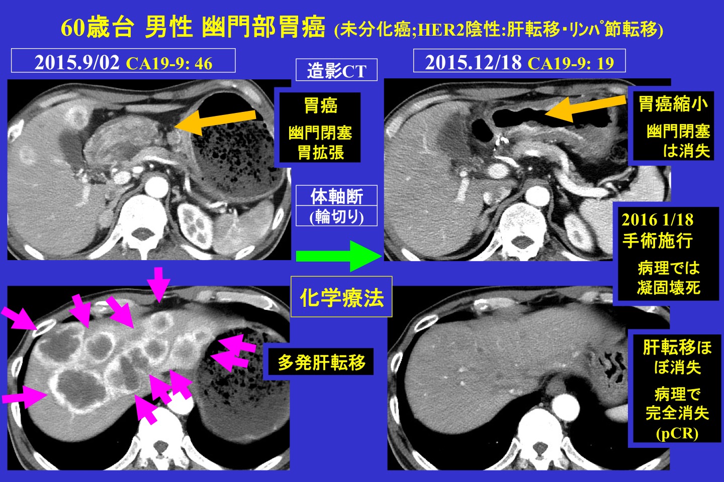 腫瘍内科