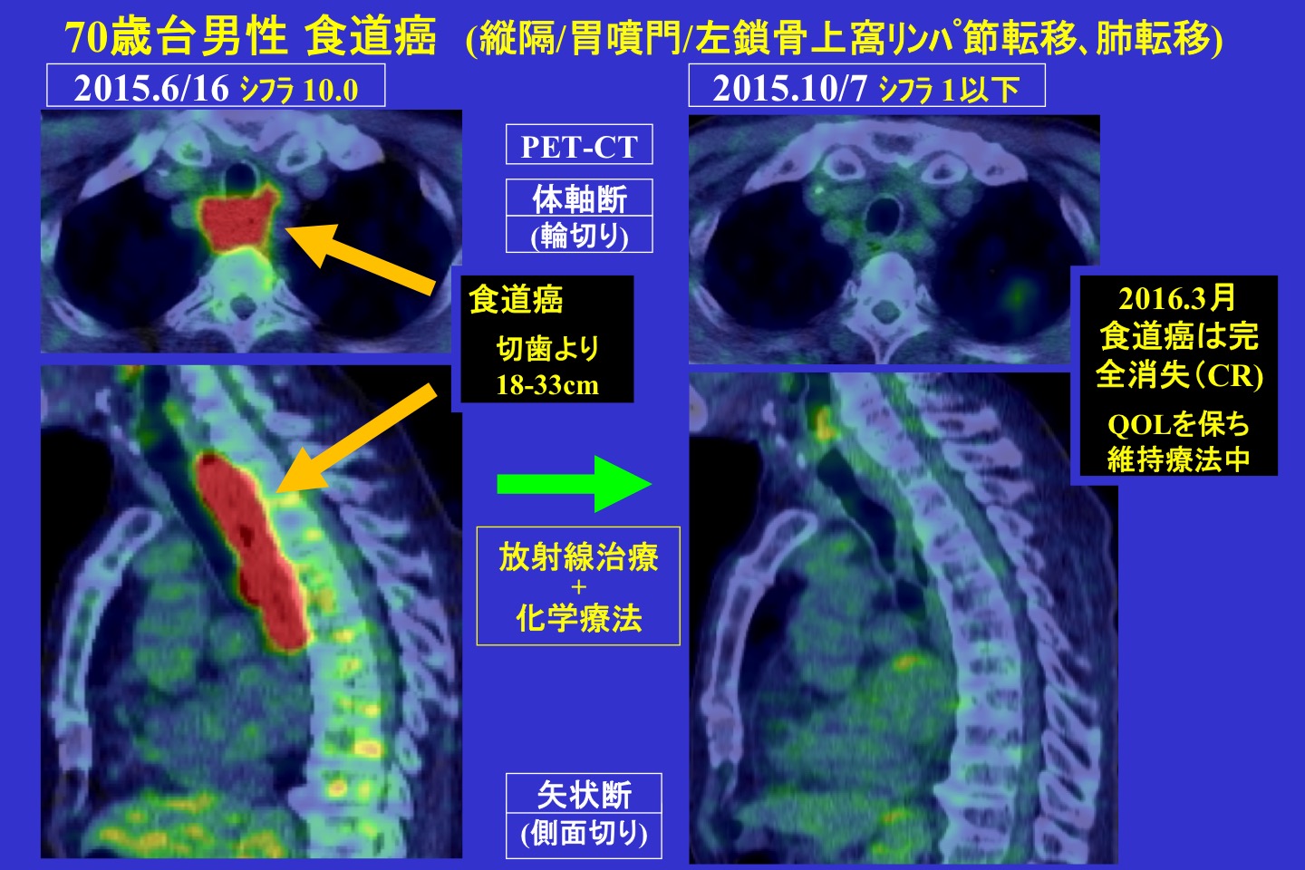 腫瘍内科