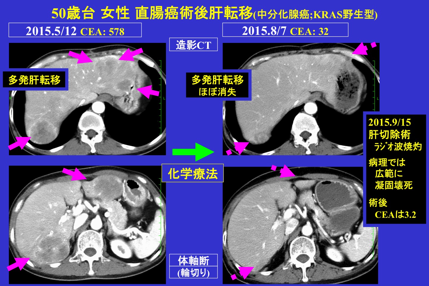 腫瘍内科